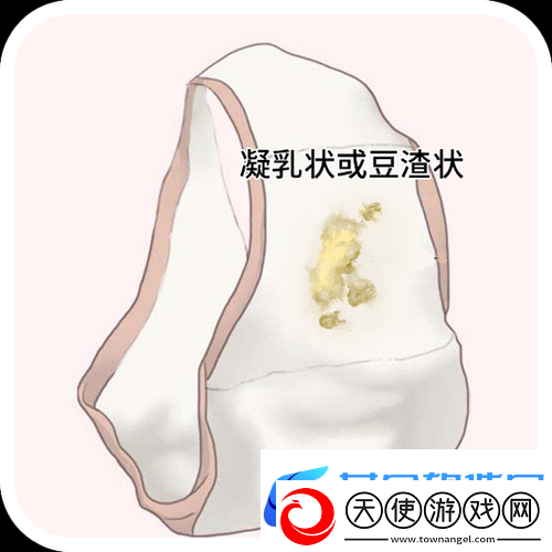 女生次数多了会有豆腐渣分泌物吗