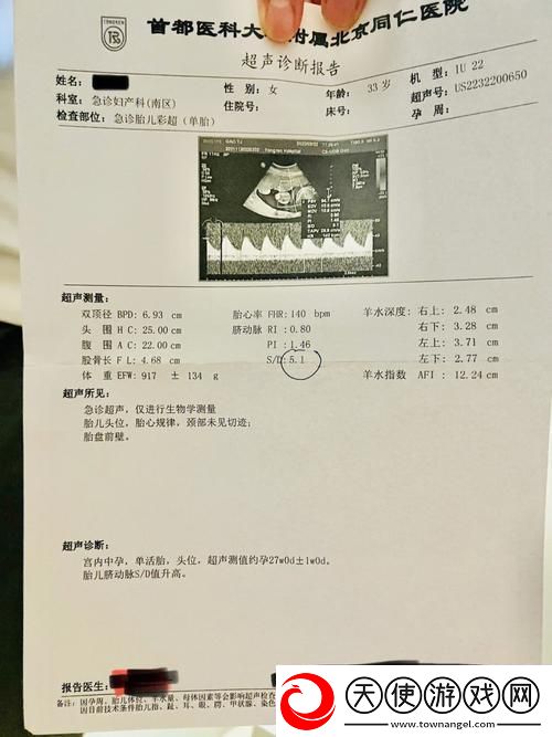 “OVO食肉族报告4”