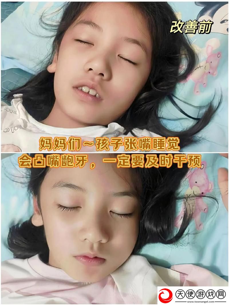 小嘴无力合拢红肿外翻图片